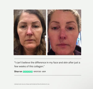 Collagen Restore™
Advanced gut + beauty boost