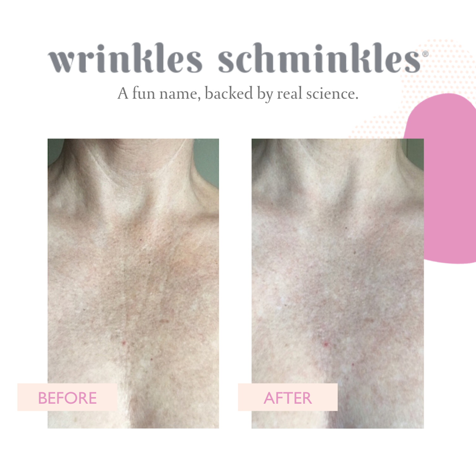 Wrinkles Schminkles - Chest & Décolletage Smoothing Patch